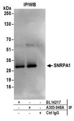 SNRPA1 Antibody in Western Blot (WB)