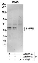 SNUPN Antibody in Immunoprecipitation (IP)