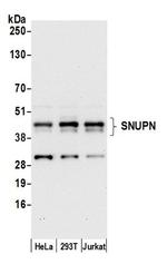 SNUPN Antibody in Western Blot (WB)