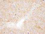 SNX1 Antibody in Immunohistochemistry (IHC)