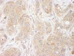 SNX1 Antibody in Immunohistochemistry (IHC)