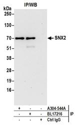 SNX2 Antibody in Western Blot (WB)