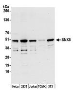 SNX5 Antibody in Western Blot (WB)