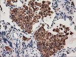 SNX8 Antibody in Immunohistochemistry (Paraffin) (IHC (P))