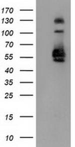 SNX8 Antibody in Western Blot (WB)