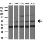 SNX8 Antibody in Western Blot (WB)