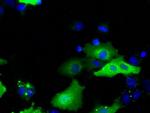 SNX9 Antibody in Immunocytochemistry (ICC/IF)