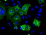 SNX9 Antibody in Immunocytochemistry (ICC/IF)