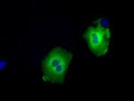 SNX9 Antibody in Immunocytochemistry (ICC/IF)