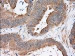 SNX9 Antibody in Immunohistochemistry (Paraffin) (IHC (P))