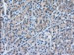 SNX9 Antibody in Immunohistochemistry (Paraffin) (IHC (P))