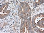 SNX9 Antibody in Immunohistochemistry (Paraffin) (IHC (P))