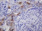 SOAT2 Antibody in Immunohistochemistry (Paraffin) (IHC (P))