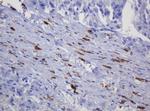 SOAT2 Antibody in Immunohistochemistry (Paraffin) (IHC (P))