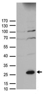 SOCS1 Antibody in Western Blot (WB)