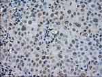 SOD1 Antibody in Immunohistochemistry (Paraffin) (IHC (P))