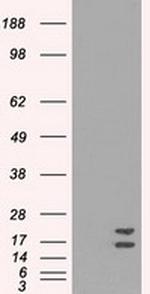 SOD1 Antibody in Western Blot (WB)