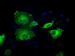 SORD Antibody in Immunocytochemistry (ICC/IF)