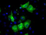 SORD Antibody in Immunocytochemistry (ICC/IF)