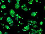 SORD Antibody in Immunocytochemistry (ICC/IF)