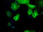 SORD Antibody in Immunocytochemistry (ICC/IF)