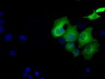 SORD Antibody in Immunocytochemistry (ICC/IF)