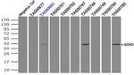 SORD Antibody in Immunoprecipitation (IP)