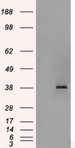 SORD Antibody in Western Blot (WB)