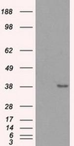 SORD Antibody in Western Blot (WB)