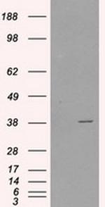 SORD Antibody in Western Blot (WB)