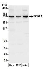 SORL1 Antibody in Western Blot (WB)