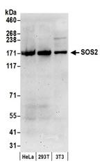 SOS2 Antibody in Western Blot (WB)