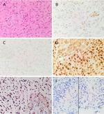 SOX2 Antibody in Immunohistochemistry (Paraffin) (IHC (P))