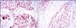 SOX2 Antibody in Immunohistochemistry (Paraffin) (IHC (P))