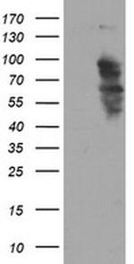 SOX5 Antibody in Western Blot (WB)