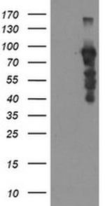 SOX5 Antibody in Western Blot (WB)