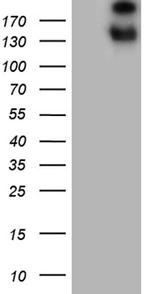 SPAG5 Antibody in Western Blot (WB)