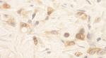 SPAK Antibody in Immunohistochemistry (IHC)