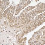 SPF45 Antibody in Immunohistochemistry (IHC)