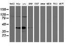 SPG7 Antibody in Western Blot (WB)