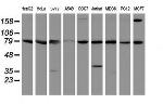 SPG7 Antibody in Western Blot (WB)