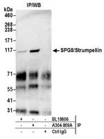 SPG8/Strumpellin Antibody in Western Blot (WB)