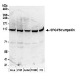 SPG8/Strumpellin Antibody in Western Blot (WB)