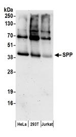 SPP Antibody in Western Blot (WB)