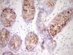 SPP1 Antibody in Immunohistochemistry (Paraffin) (IHC (P))