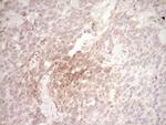 SPP1 Antibody in Immunohistochemistry (Paraffin) (IHC (P))