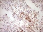 SPP1 Antibody in Immunohistochemistry (Paraffin) (IHC (P))