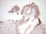 SPP1 Antibody in Immunohistochemistry (Paraffin) (IHC (P))