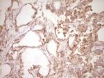 SPP1 Antibody in Immunohistochemistry (Paraffin) (IHC (P))