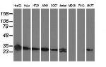 SPR Antibody in Western Blot (WB)